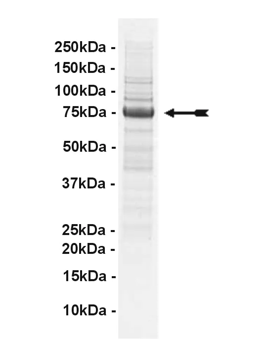 PEK, active Human Recombinant Kinase Protein