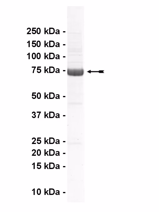 ErbB2, active Human Recombinant Kinase Protein