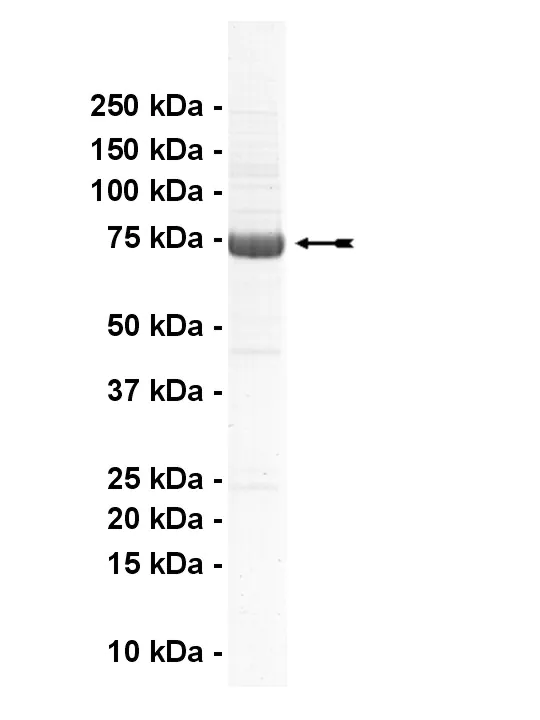 ErbB2, active Human Recombinant Kinase Protein