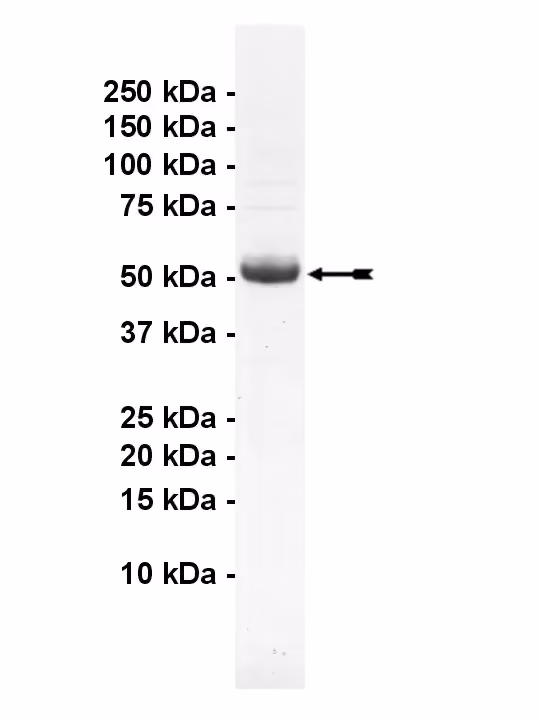 CaM Kinase IIα, active Human Recombinant Kinase Protein