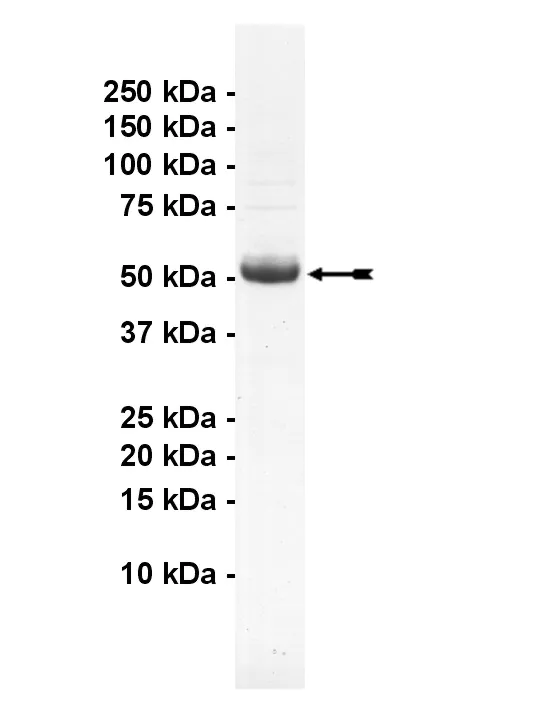CaM Kinase IIα, active Human Recombinant Kinase Protein