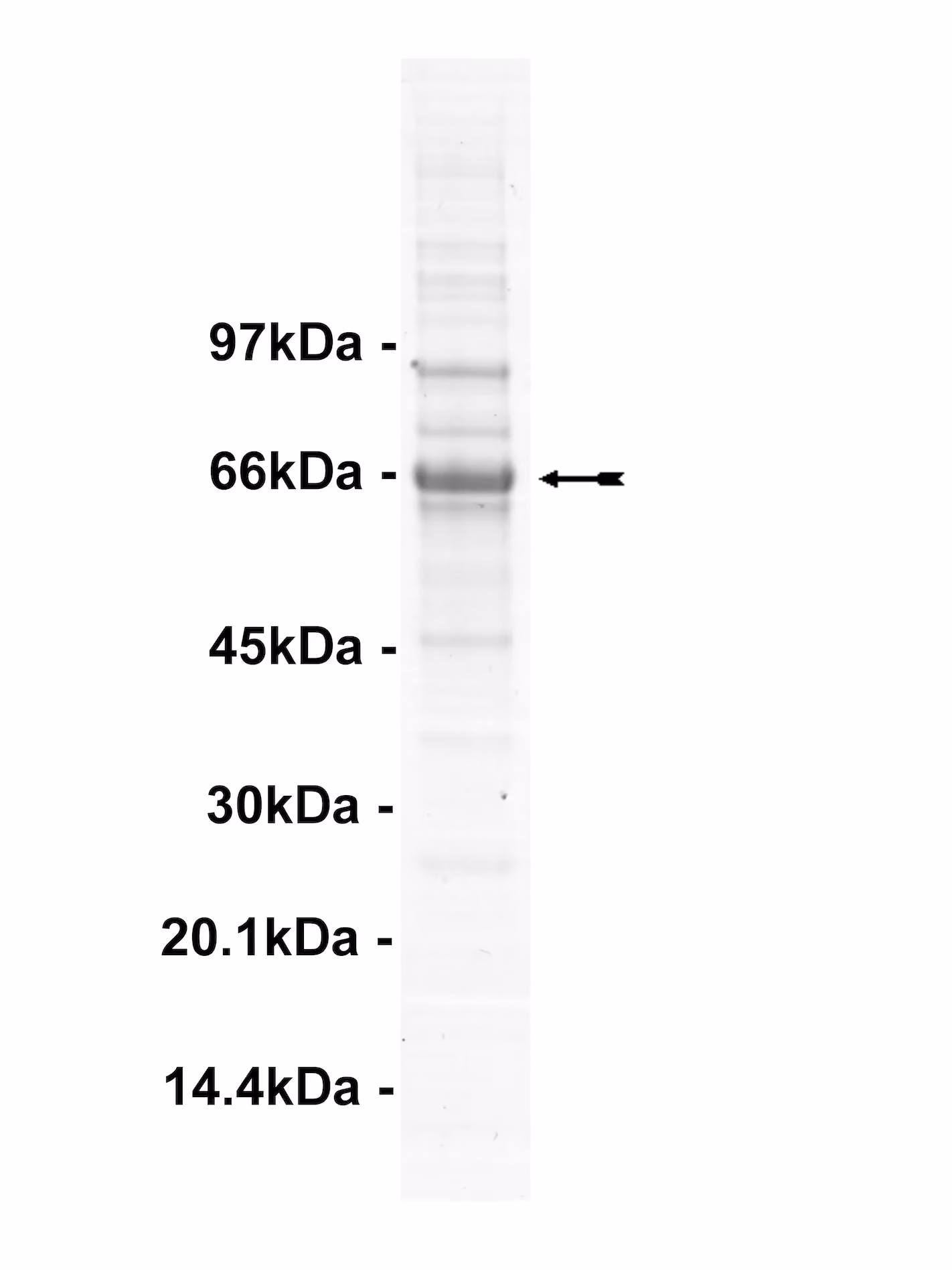 ALK1, active Human Recombinant Kinase Protein