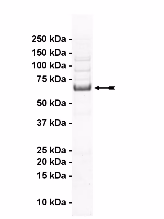 PKR, active Human Recombinant Kinase Protein