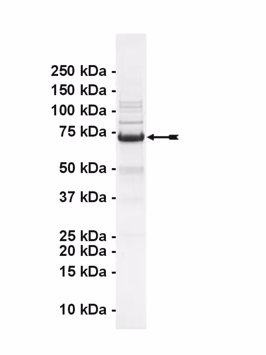 MYLK2, active Human Recombinant Kinase Protein