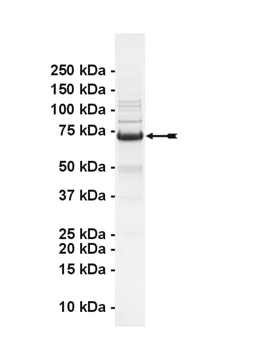 MYLK2, active Human Recombinant Kinase Protein