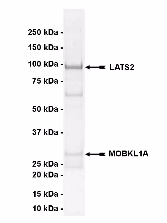 LATS2, active Human Recombinant Kinase Protein