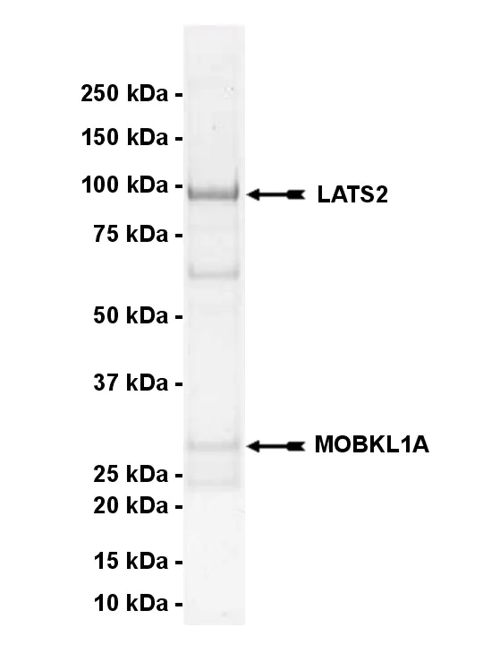 LATS2, active Human Recombinant Kinase Protein