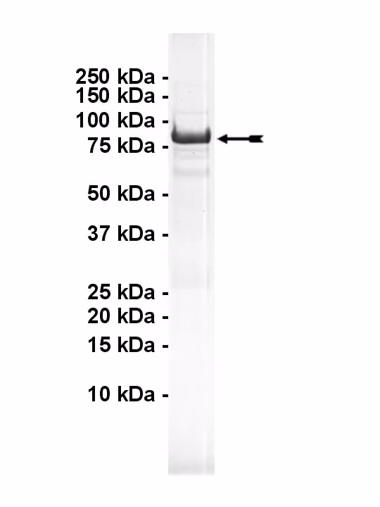 ChaK1, active Human Recombinant Kinase Protein