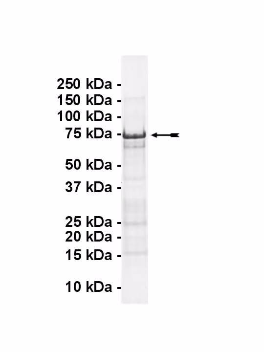 p53 (expressed in E.coli) Human Recombinant Kinase Protein
