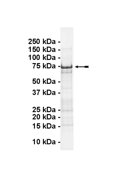 p53 (expressed in E.coli) Human Recombinant Kinase Protein