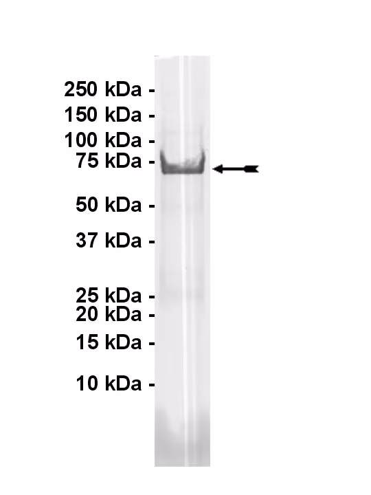 NIM1, active Human Recombinant Kinase Protein