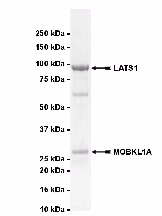 LATS1, active Human Recombinant Kinase Protein