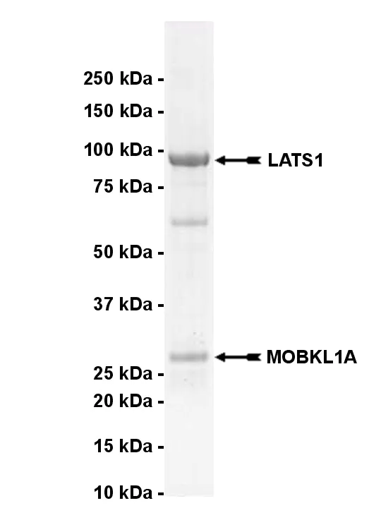 LATS1, active Human Recombinant Kinase Protein
