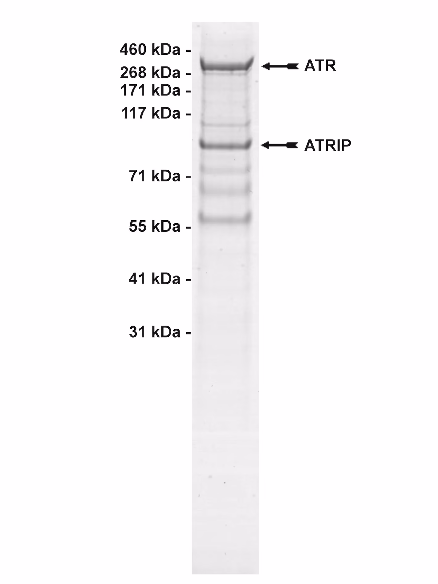 ATR/ATRIP, active Human Recombinant Kinase Protein