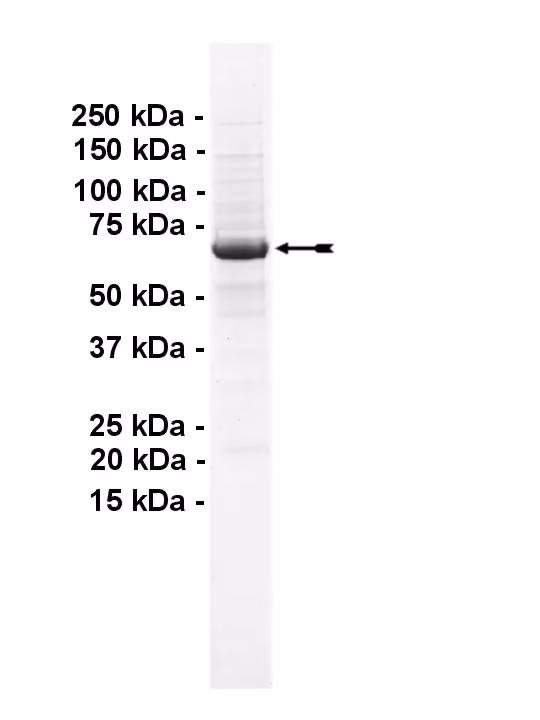GRK1, active Human Recombinant Kinase Protein