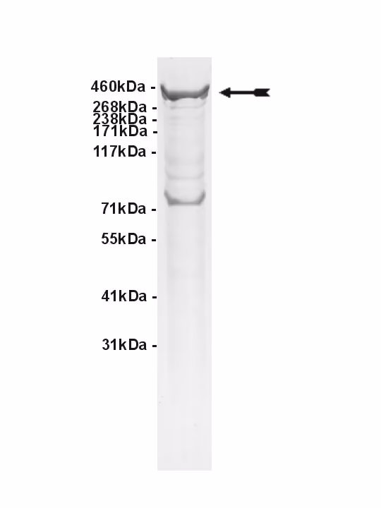 ATM, active Human Recombinant Kinase Protein