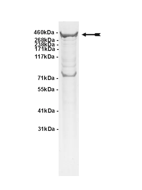 ATM, active Human Recombinant Kinase Protein