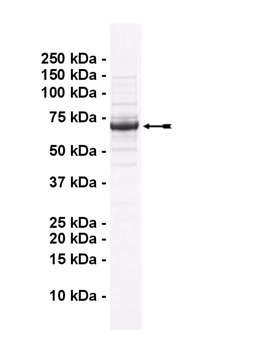 CaMKK2, active Human Recombinant Kinase Protein