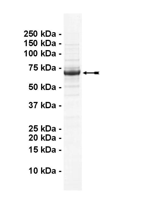CaMKK2, active Human Recombinant Kinase Protein