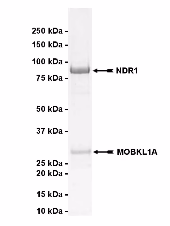 NDR1, active Human Recombinant Kinase Protein