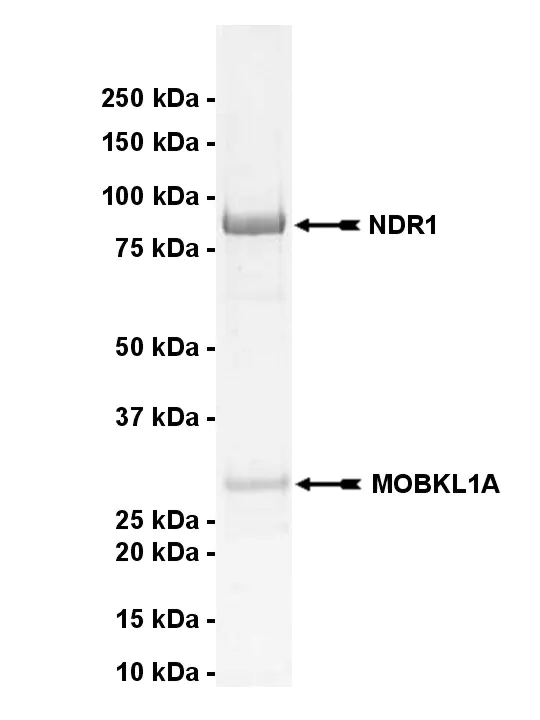 NDR1, active Human Recombinant Kinase Protein