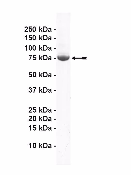 GRK2, active Human Recombinant Kinase Protein