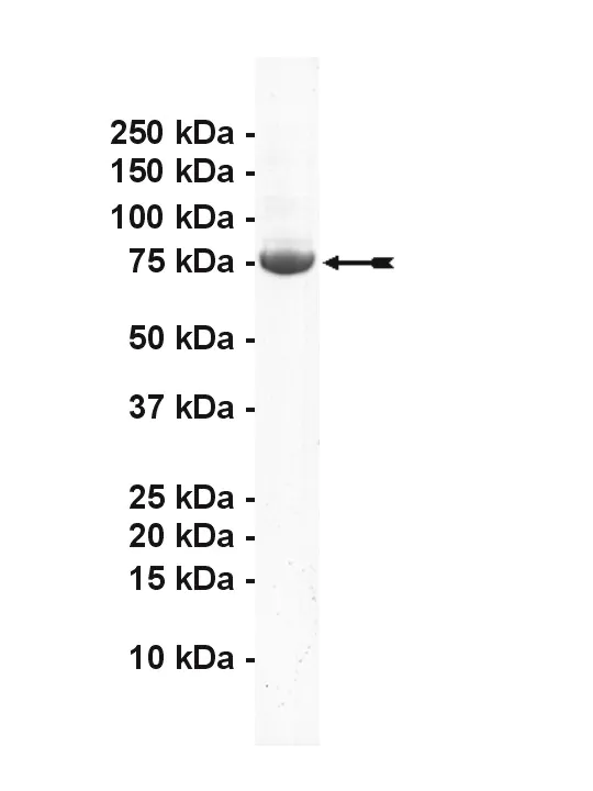 GRK2, active Human Recombinant Kinase Protein