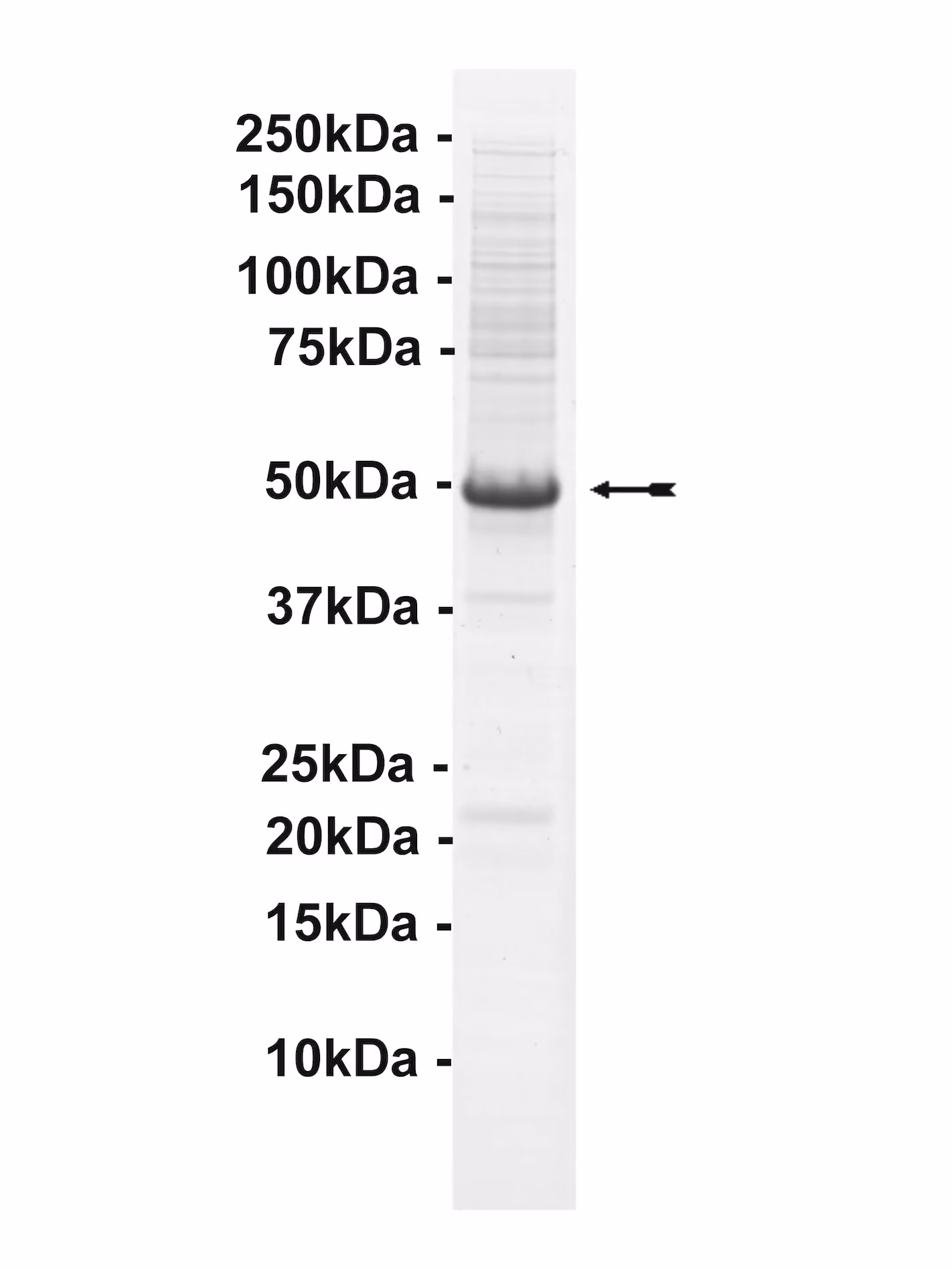STK32A, active Human Recombinant Kinase Protein