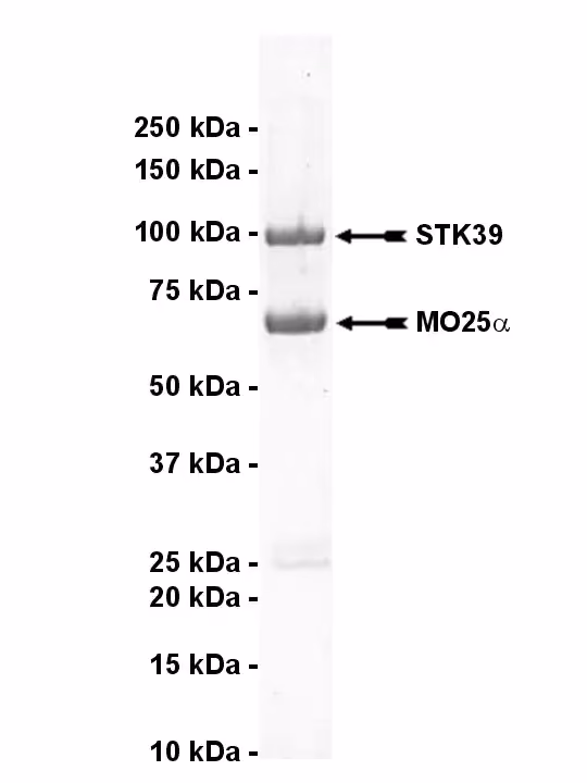 STK39, active Human Recombinant Kinase Protein