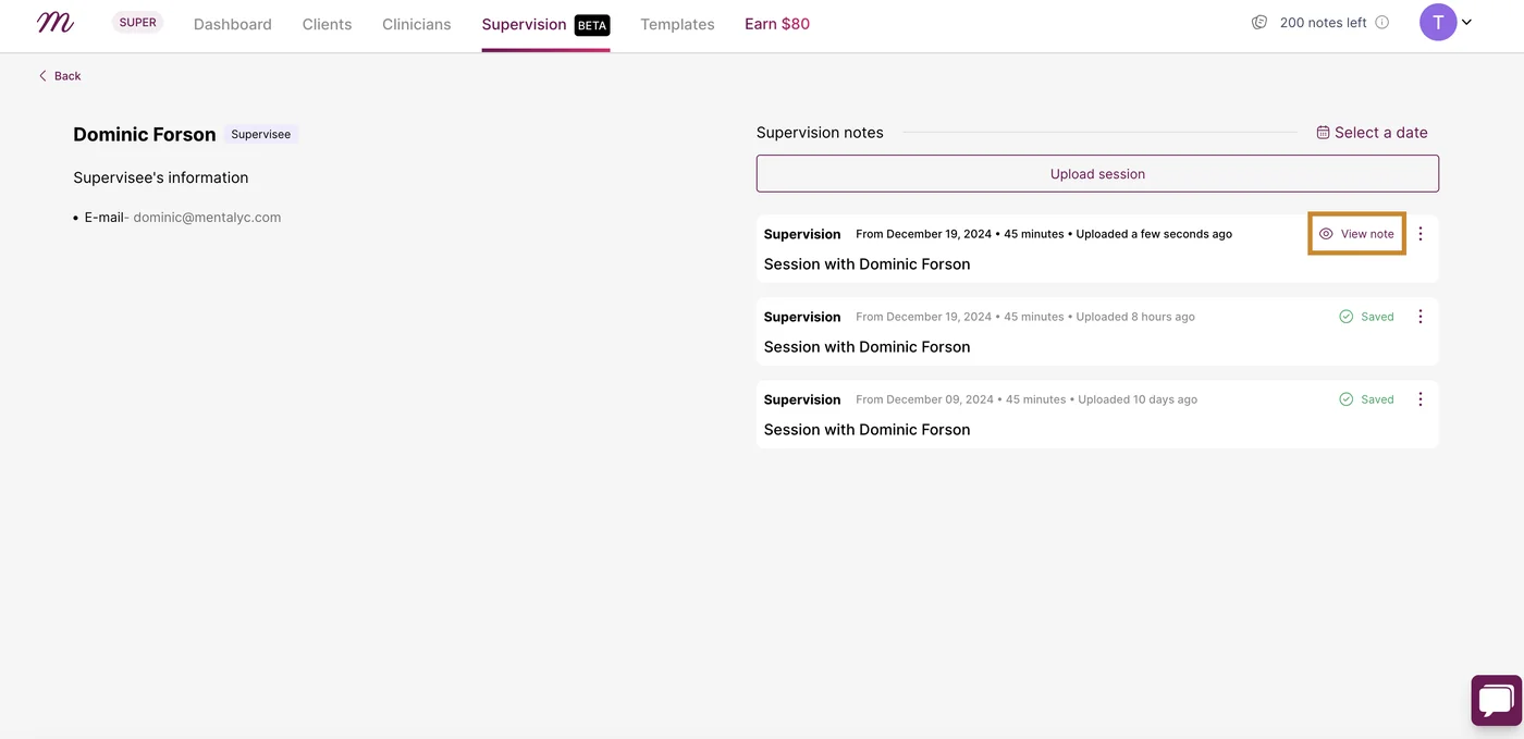 Screenshot: After the transcript has been successfully generated, click on 'View note' to be able to view the note details