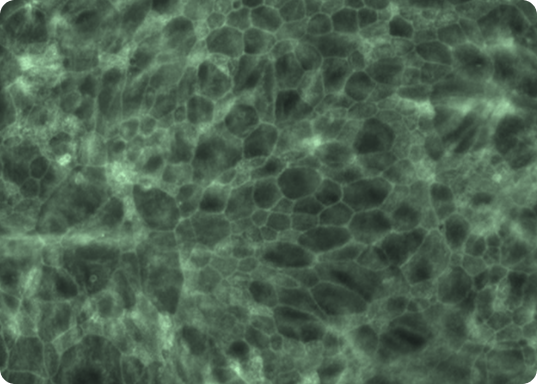 Gut Defense: How IgG Binding Protein LT Supports Barrier Integrity Over Conventional Immunoglobulins