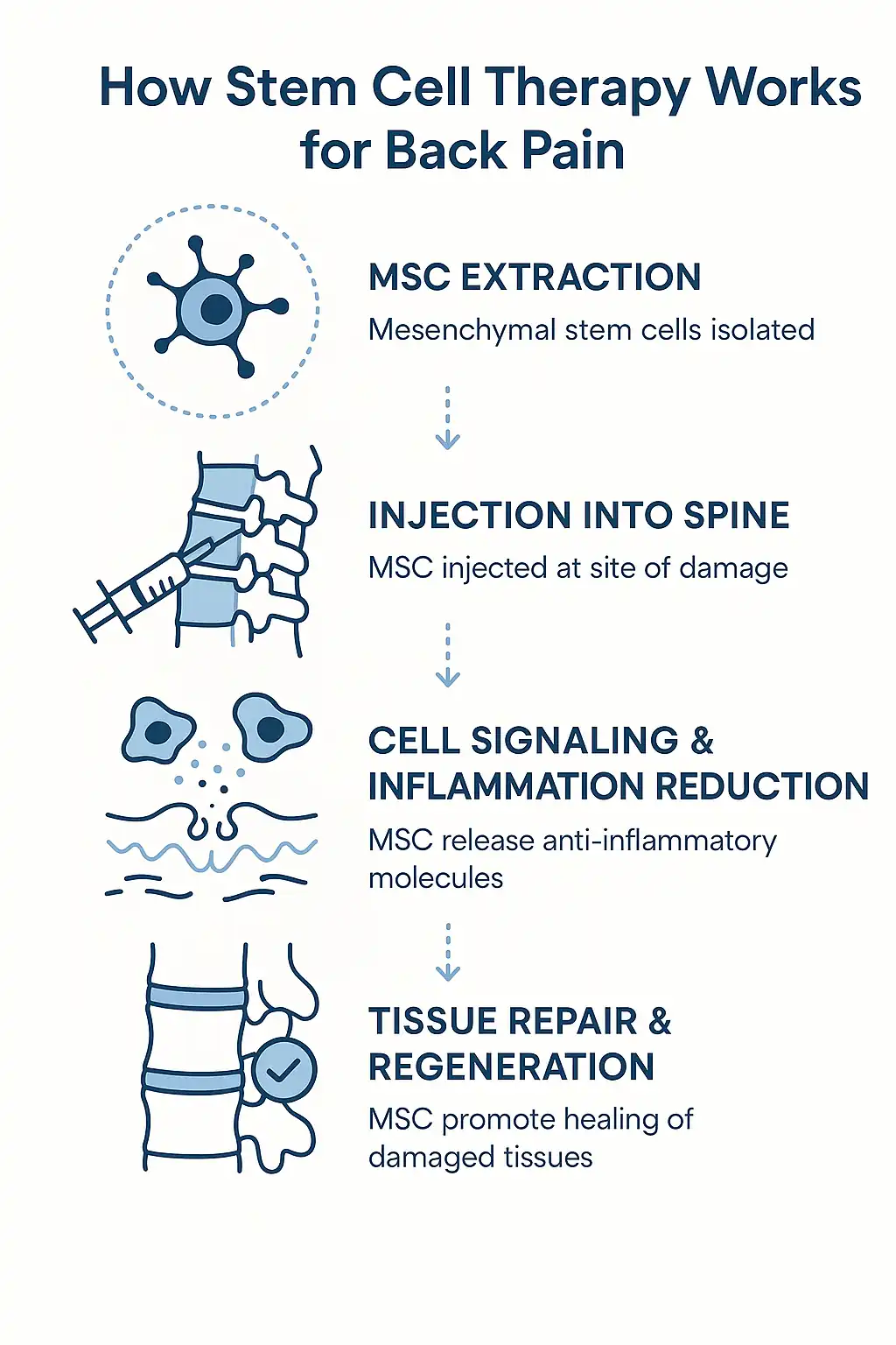 Infographic explaining how stem cell therapy for back pain works, showing MSC extraction, spinal injection, inflammation reduction, and tissue regeneration.