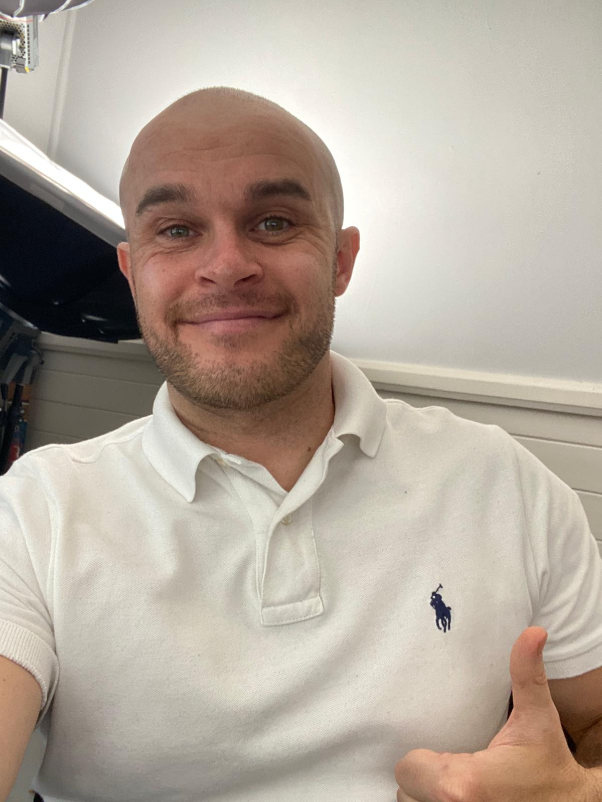 Wollongong Handsome Man - Bald is Back Baby