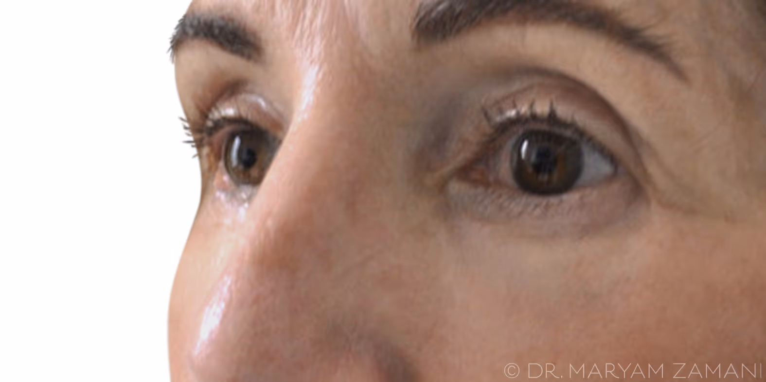 Close-up of a woman's eyes and nose showing smooth skin texture.