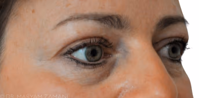 Close-up of a person's eyes and nose, showing gray eyes with dark eyelashes and eyebrows.