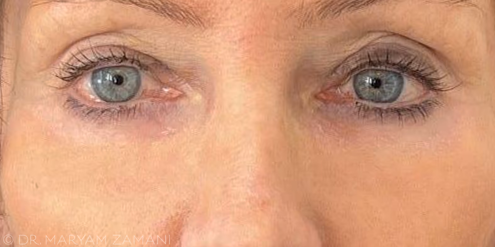 Close-up of a person's blue-gray eyes with natural eyelashes and light skin tone.