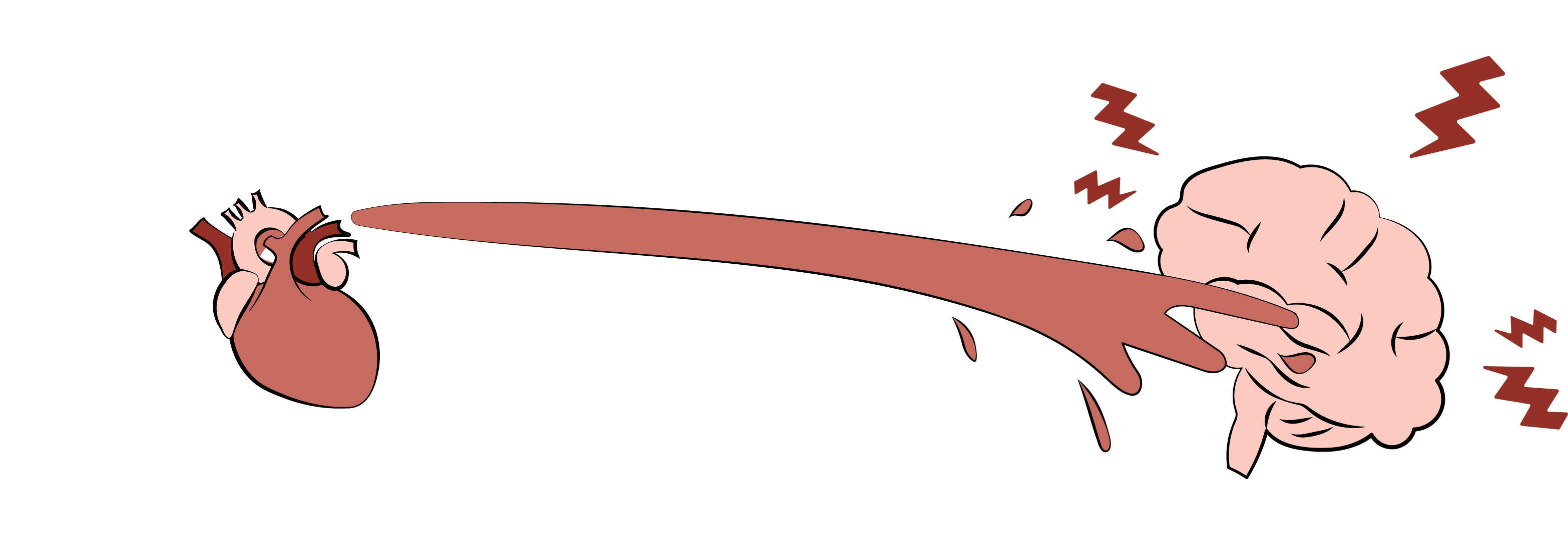 A heart shooting blood forcefully at a brain, causing damage when it hits it. 