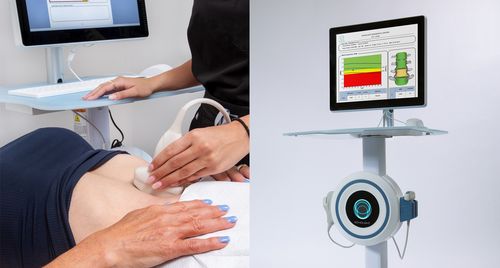 Dexa Rems REMS vs DEXA: Superior Bone Density Scans Compared