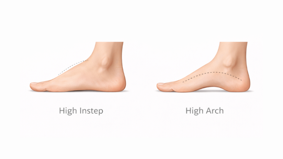 high instep vs high arch