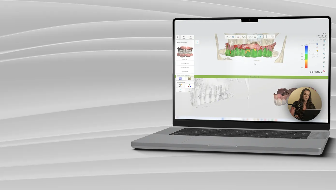 Dental 3D modeling software with teeth visualization on laptop screen