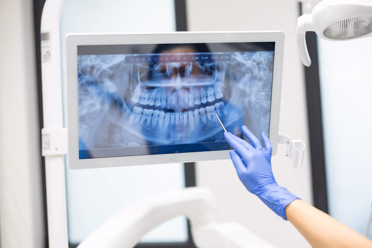 Digital X-Rays in Parker, CO