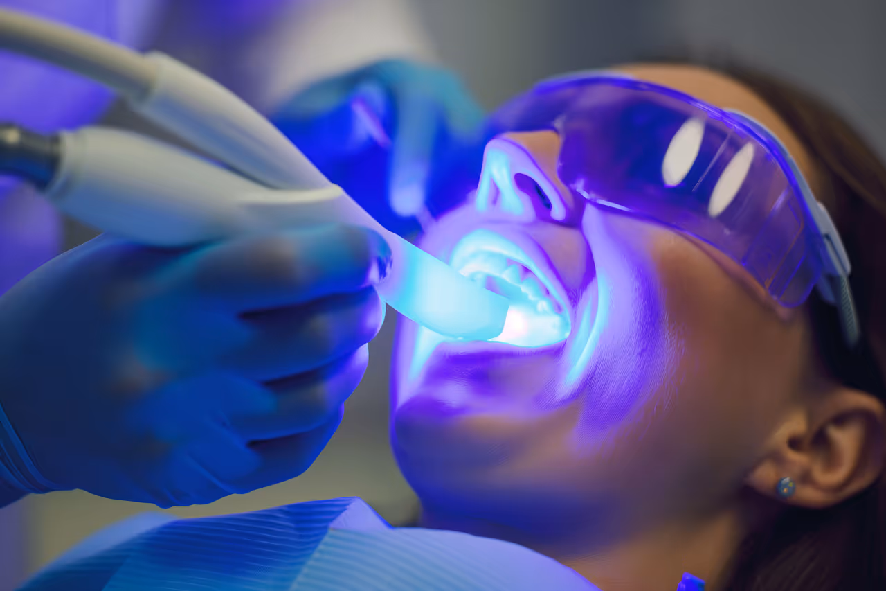 Fluoride Treatment in Parker, CO