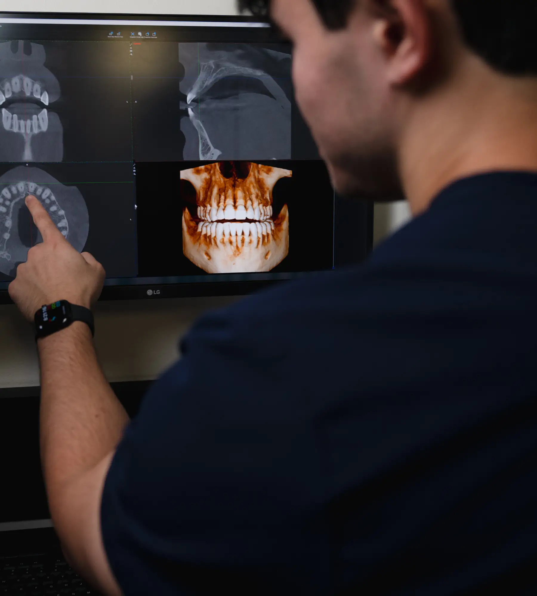 A person points at dental X-rays displayed on a computer screen.