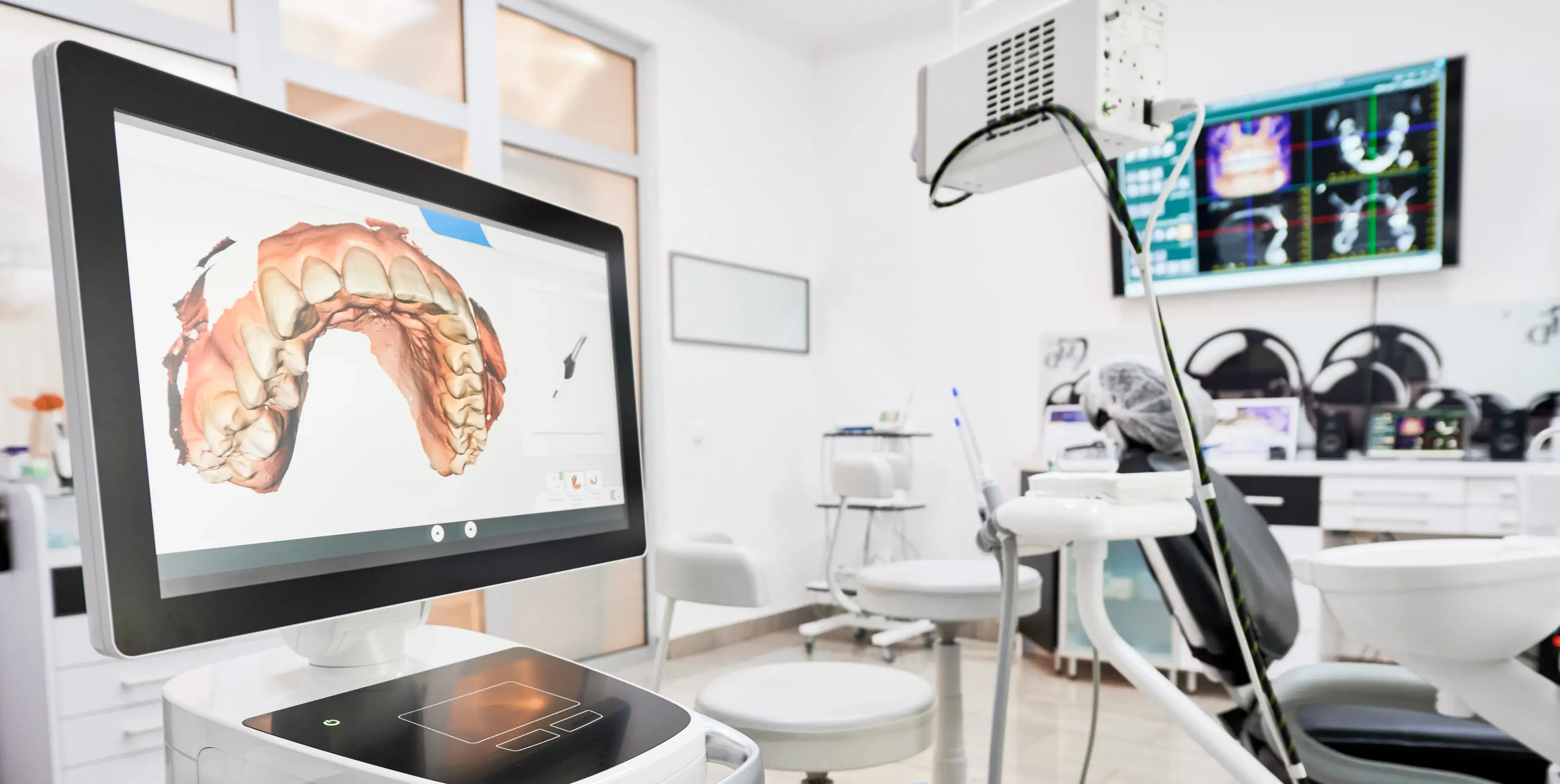 Dental clinic with a 3D dental scan displayed on a monitor next to a dental chair and equipment.