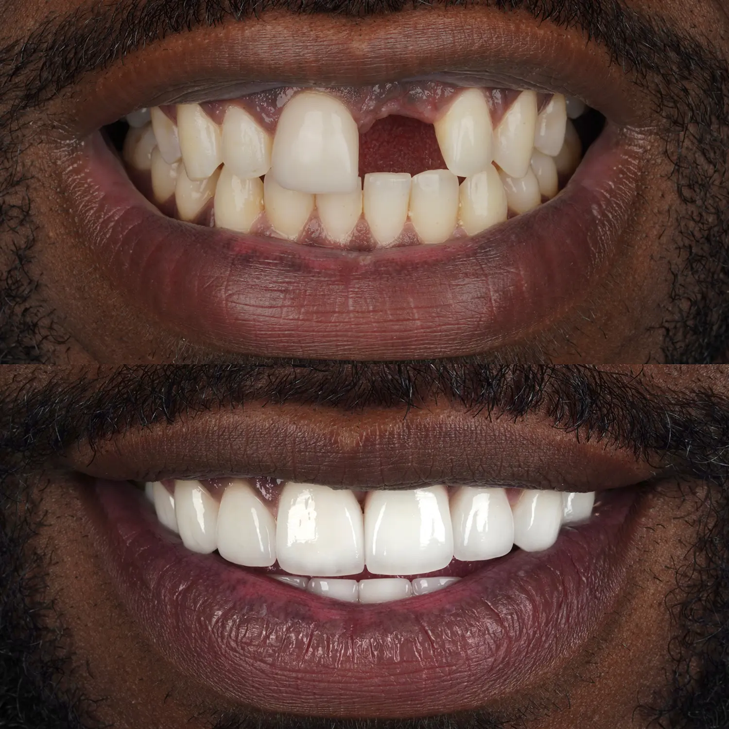 Restorative Dentistry in Houston, TX | Seviin Cosmetics
