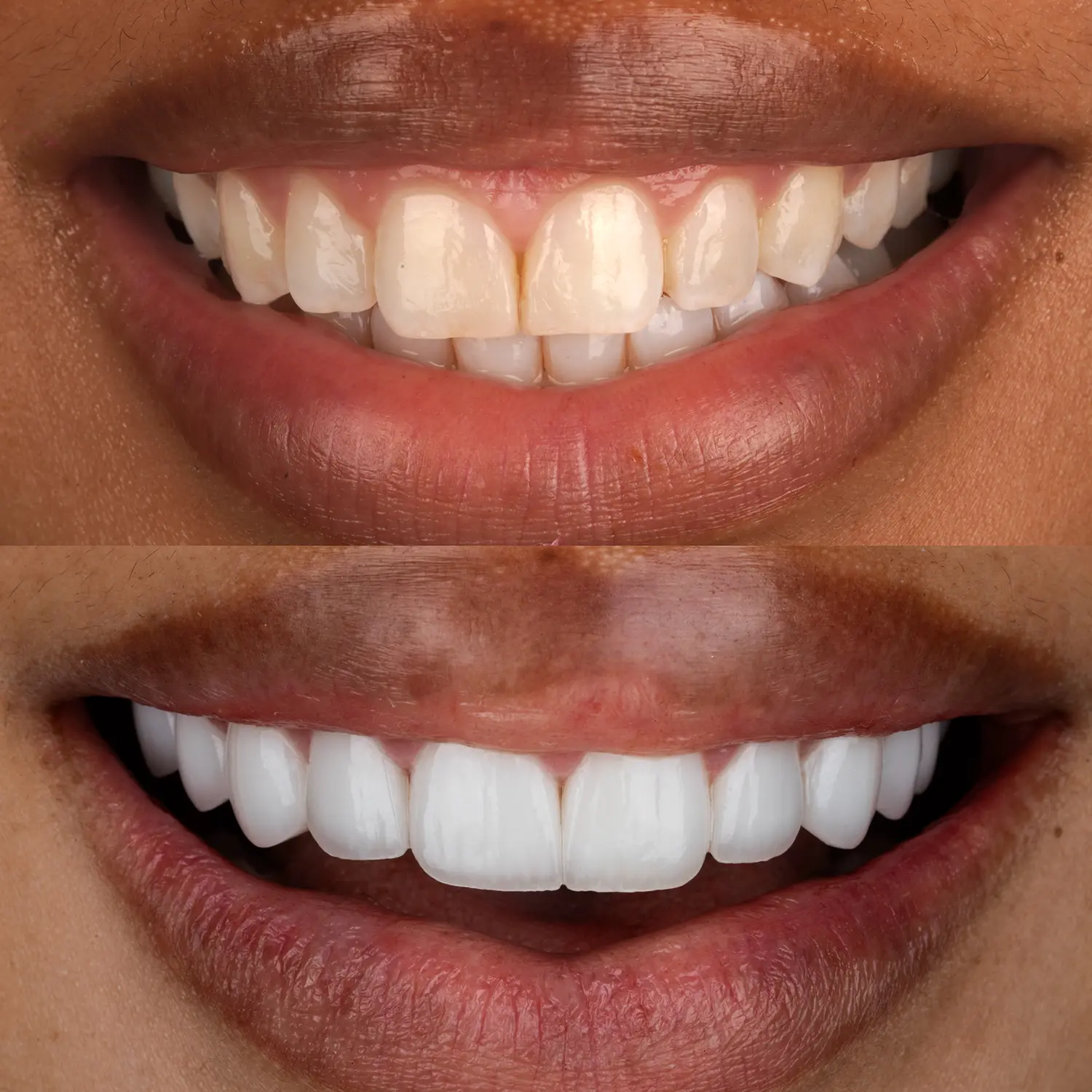Cosmetic Dentistry in Houston, TX | Seviin Cosmetics