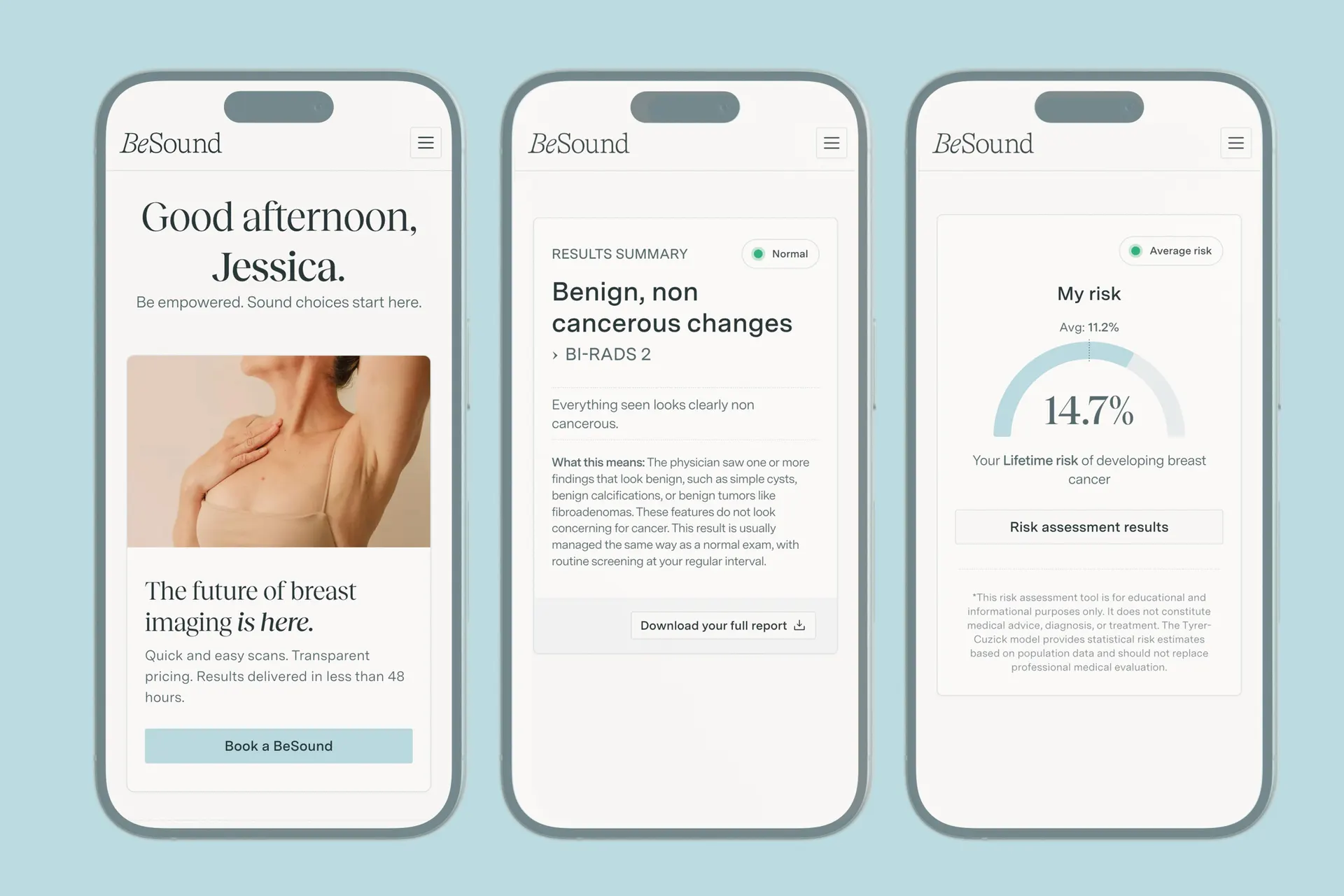 Dense Breast Imaging Exposes Mammography’s Limits