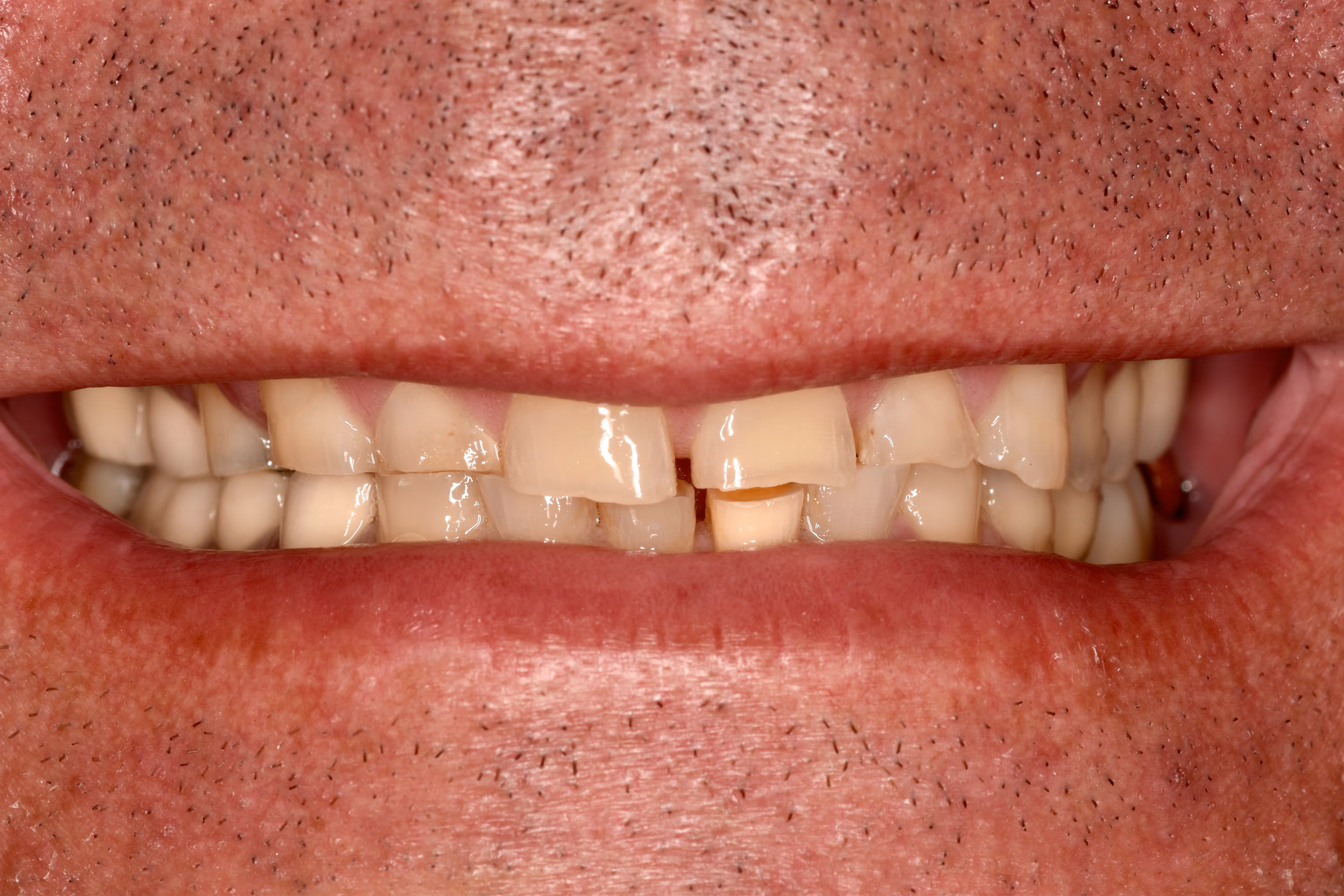 Before Image