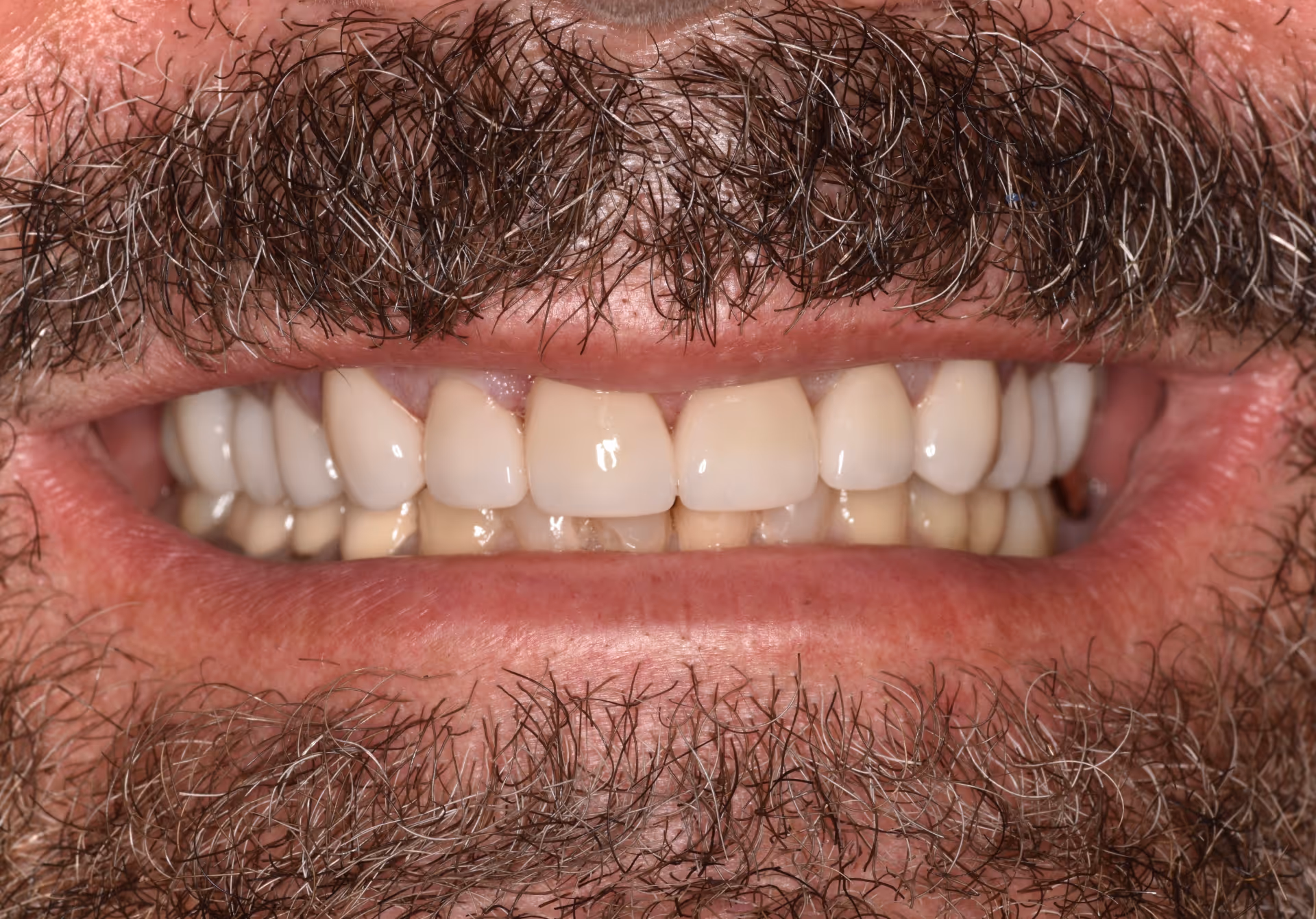 After Image