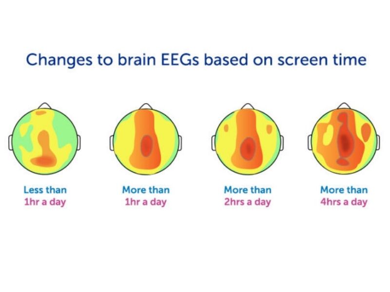 Illustration of MRI brain scan showing screen time effects on children's neural pathways, with Europe policy icons